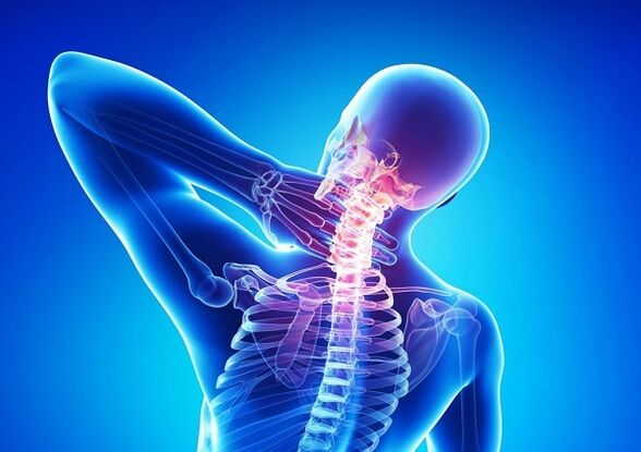 bol u kralježnici grlića maternice s osteohondrozom