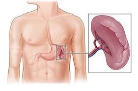 patologija slezene kao uzrok boli ispod lijeve lopatice