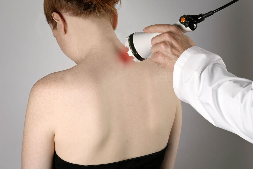 fizioterapeutsko liječenje cervikalne osteohondroze